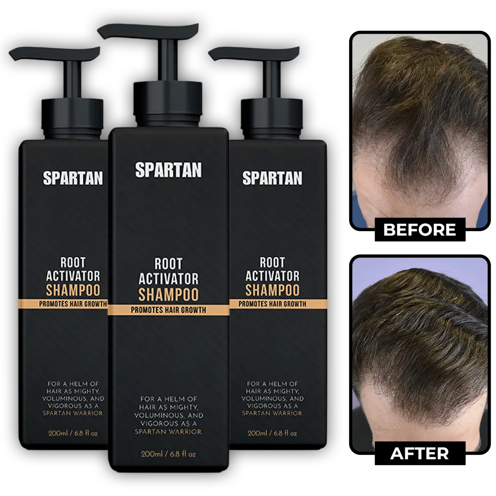 Spartan Root Activator Shampoo for men's thinning hair and scalp care