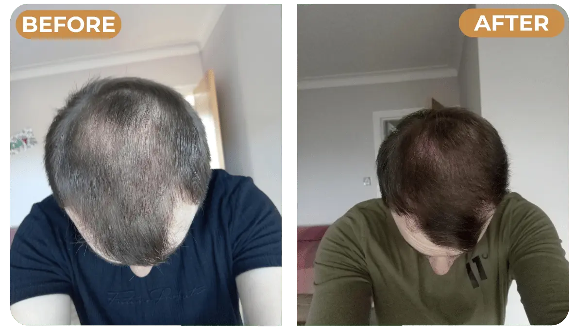 Applying Spartan shampoo to hair and scalp
