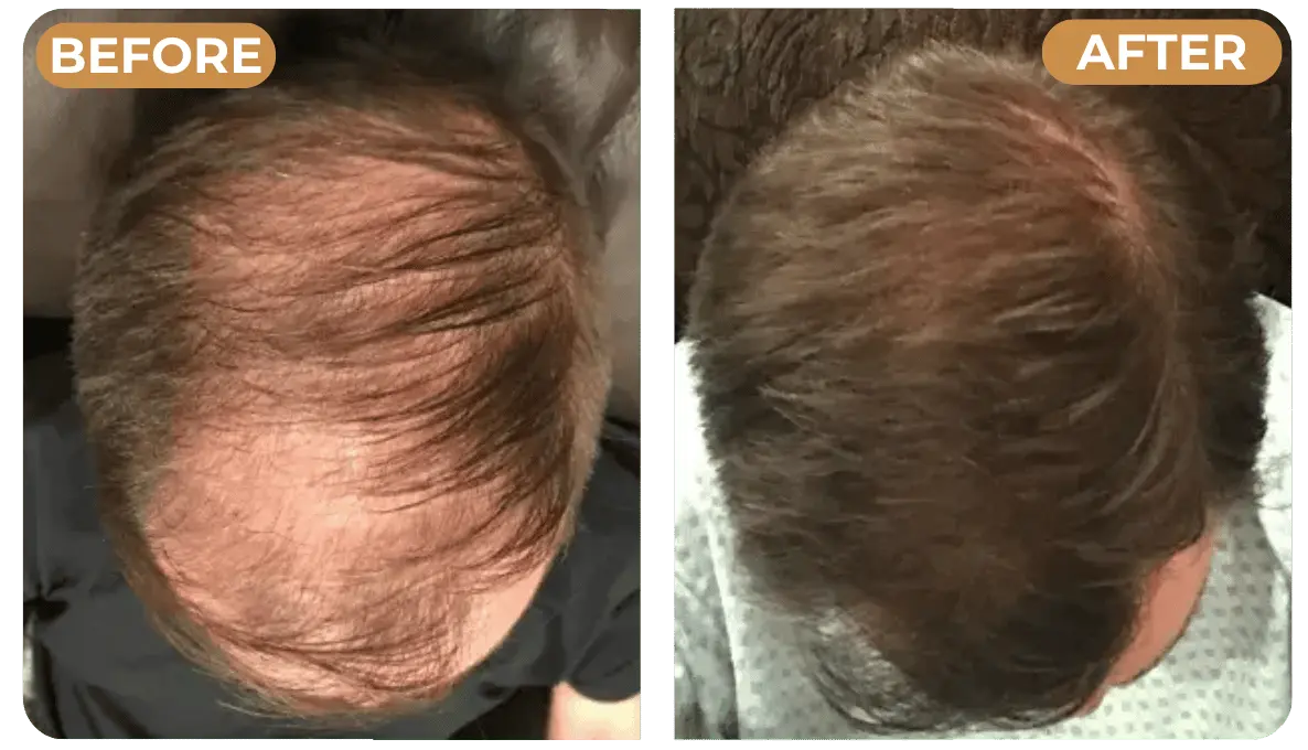 Rinsing Spartan Root Activator Shampoo from hair